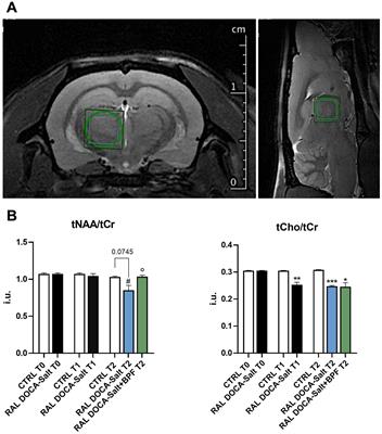 Imbalance of thalamic metabolites in an experimental model of hypertension: role of bergamot polyphenols